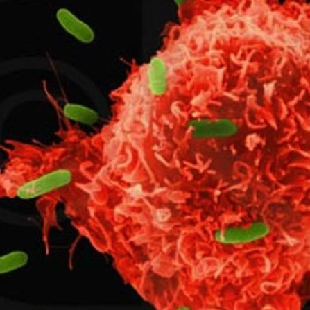 cancer cell