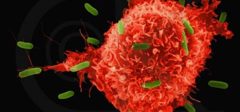 cancer cell